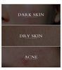 Dark Spot Turmeric Skin Care Set - Givemethisnow
