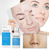 EELHOE™ Dark Spot and Acne Treatment Lotion - Givemethisnow
