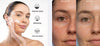 Effective Whitening Freckle Cream Remove Dark Spots - Givemethisnow