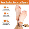GFOUK™ Foot Callus Removal Spray - Givemethisnow