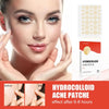 Hydrocolloid Acne Pimple Patch - Givemethisnow