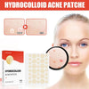 Hydrocolloid Acne Pimple Patch - Givemethisnow