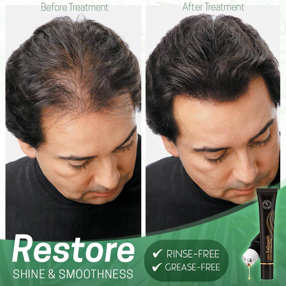 Regrowth Organic Hair Serum Roller - Givemethisnow