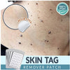 Skin Tag Remover Patches - Givemethisnow