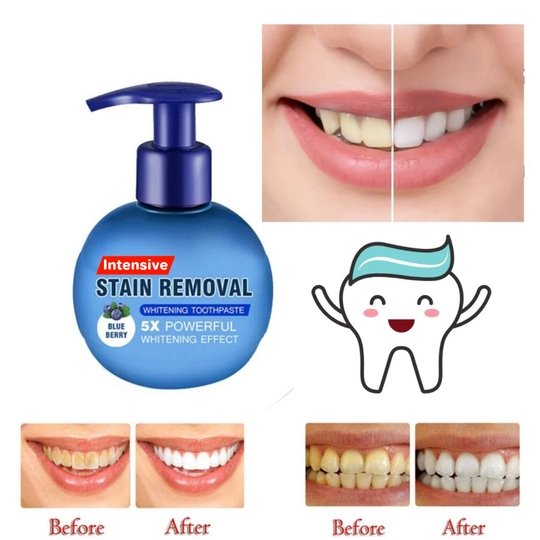 100% Intensive Stain Removal Whitening Toothpaste - Givemethisnow