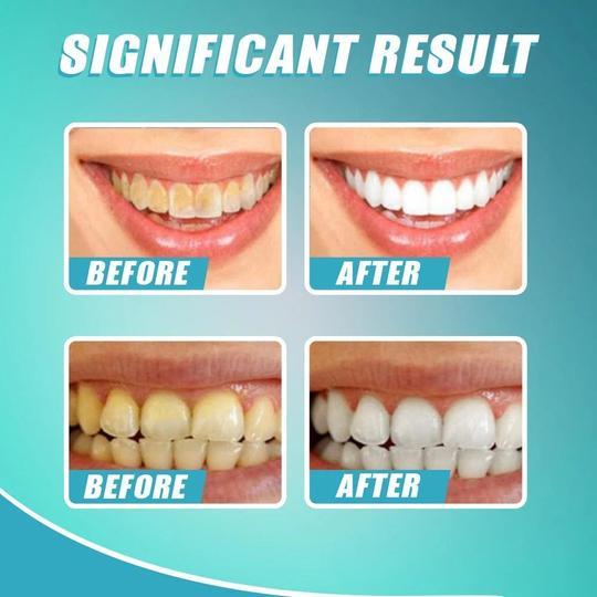 100% Intensive Stain Removal Whitening Toothpaste - Givemethisnow