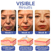 30 Day Anti-Aging Treatment Serum - Givemethisnow