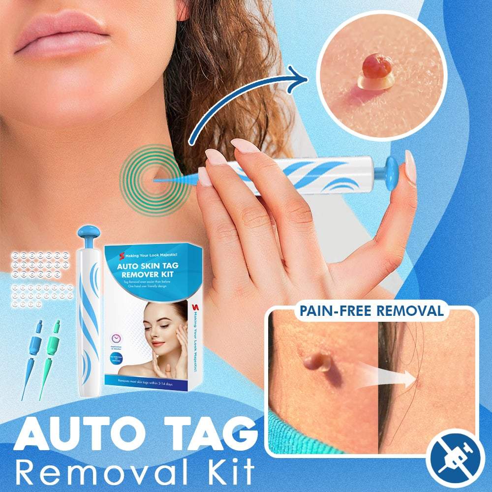 Auto Tag Removal Kit - Givemethisnow