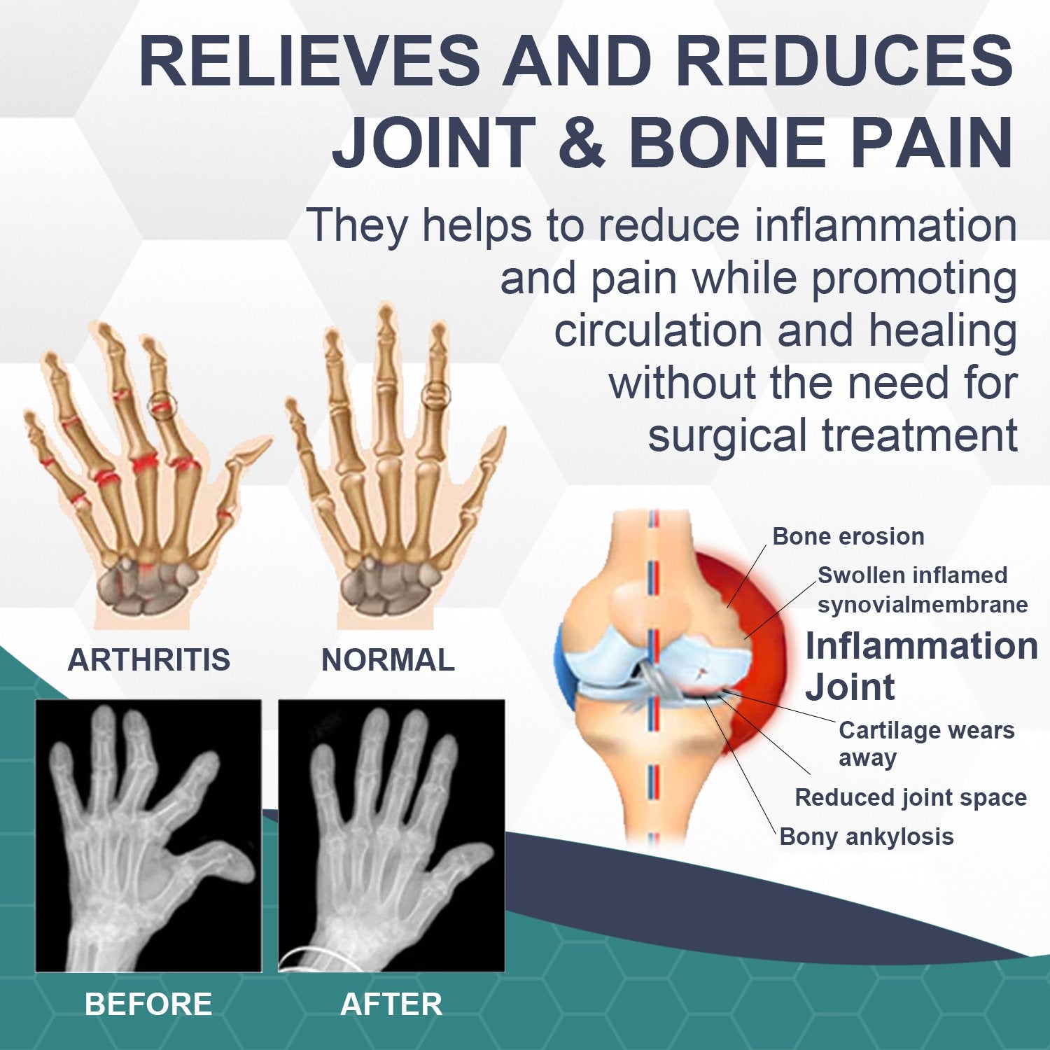 Bee Venom Pain and Bone Healing Cream - Givemethisnow