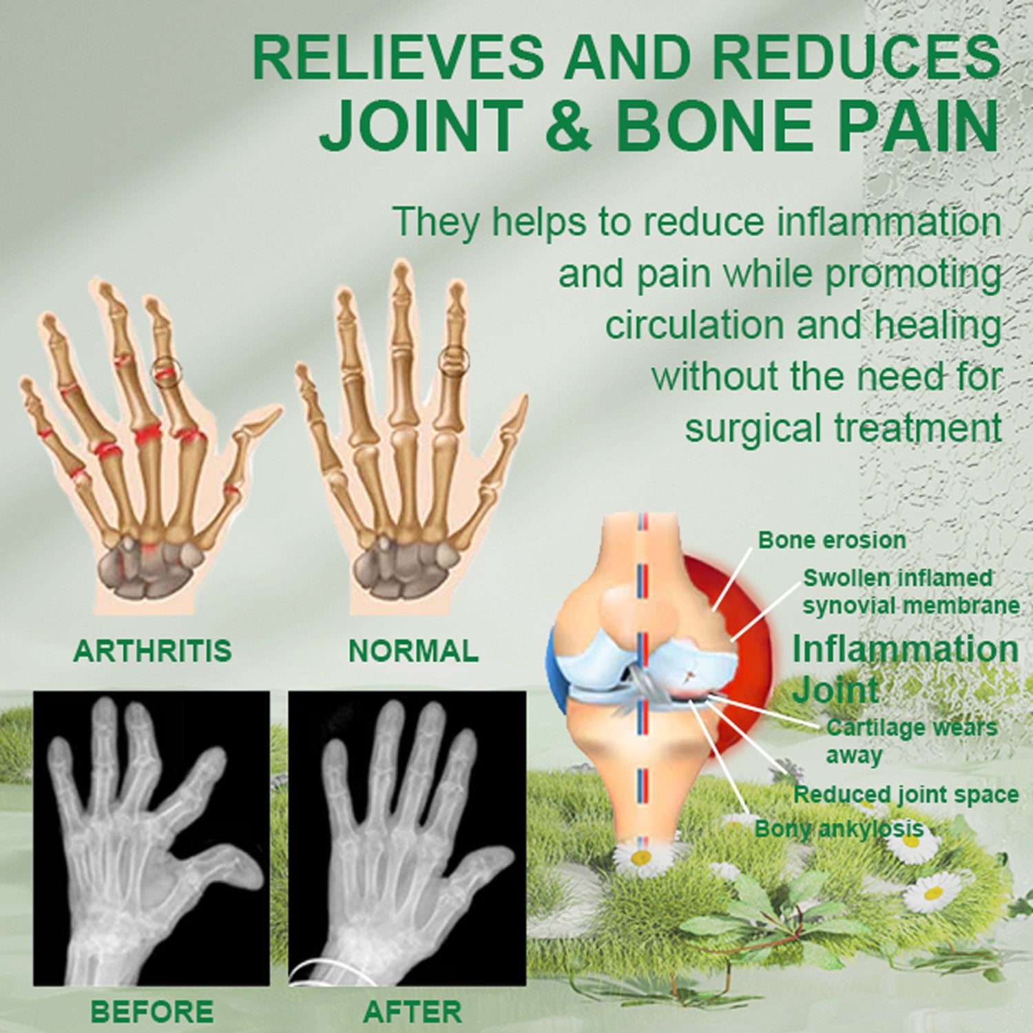 Beevana™ Bee Venom Joint & Bone Therapy Cream (Full Body Recovery, Pure Natural Formula) - Givemethisnow