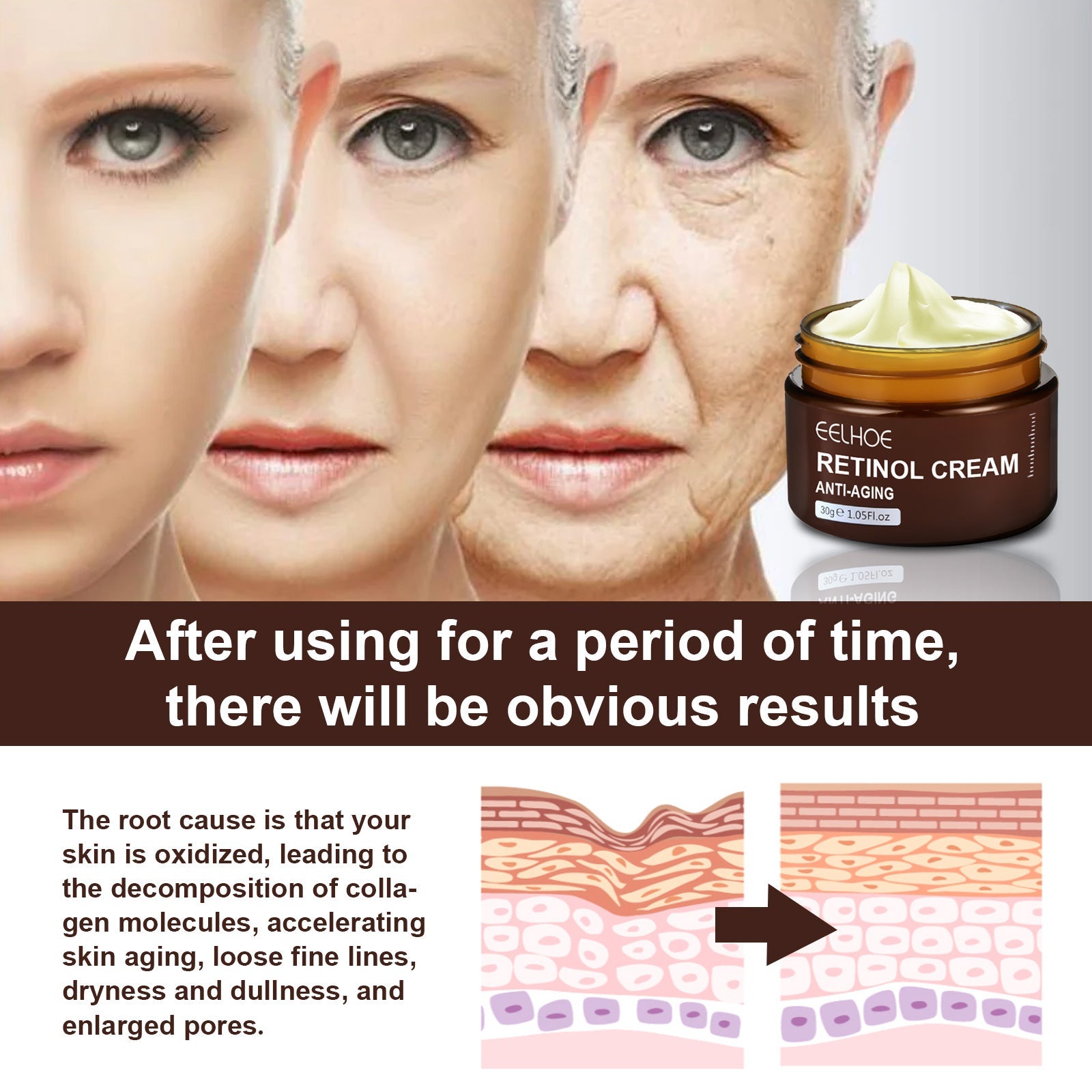 EELHOE Anti Aging Wrinkle Removal Skin Firming Cream - Givemethisnow