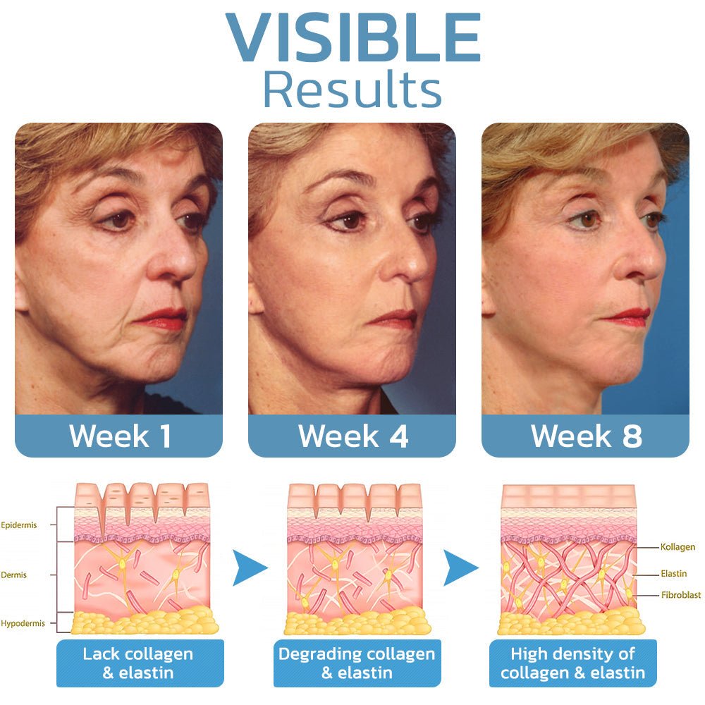 Flysmus™ BotoxLUX Anti Aging Serum - Givemethisnow