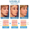 Flysmus™ BotoxLUX Anti Aging Serum - Givemethisnow