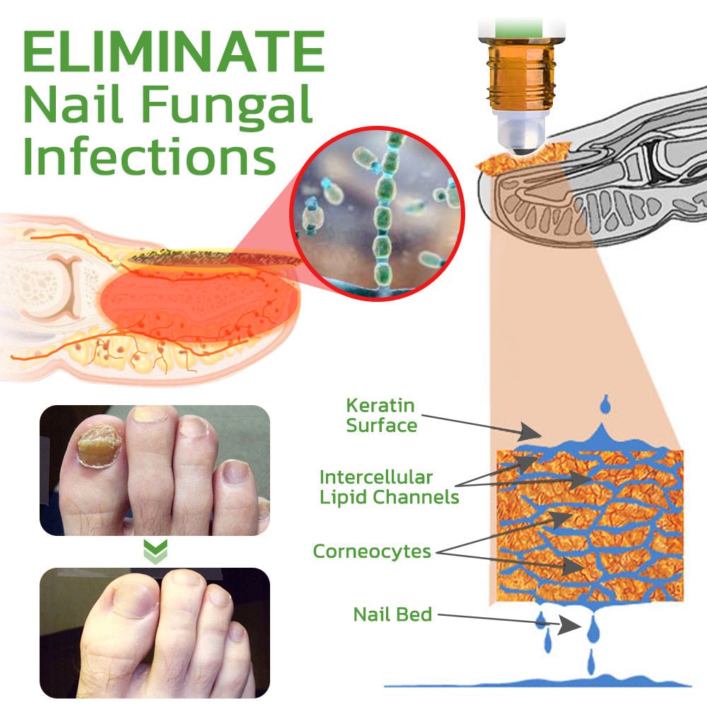 GFOUK™ 5 Days Nail Growth and Hardening Repair Roller - Givemethisnow