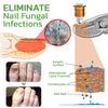 GFOUK™ 5 Days Nail Growth and Hardening Repair Roller - Givemethisnow