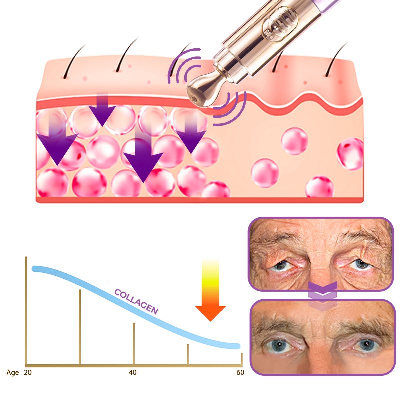 GFOUK™️ Milk Spots Therapy Electric Serum Pen - Givemethisnow