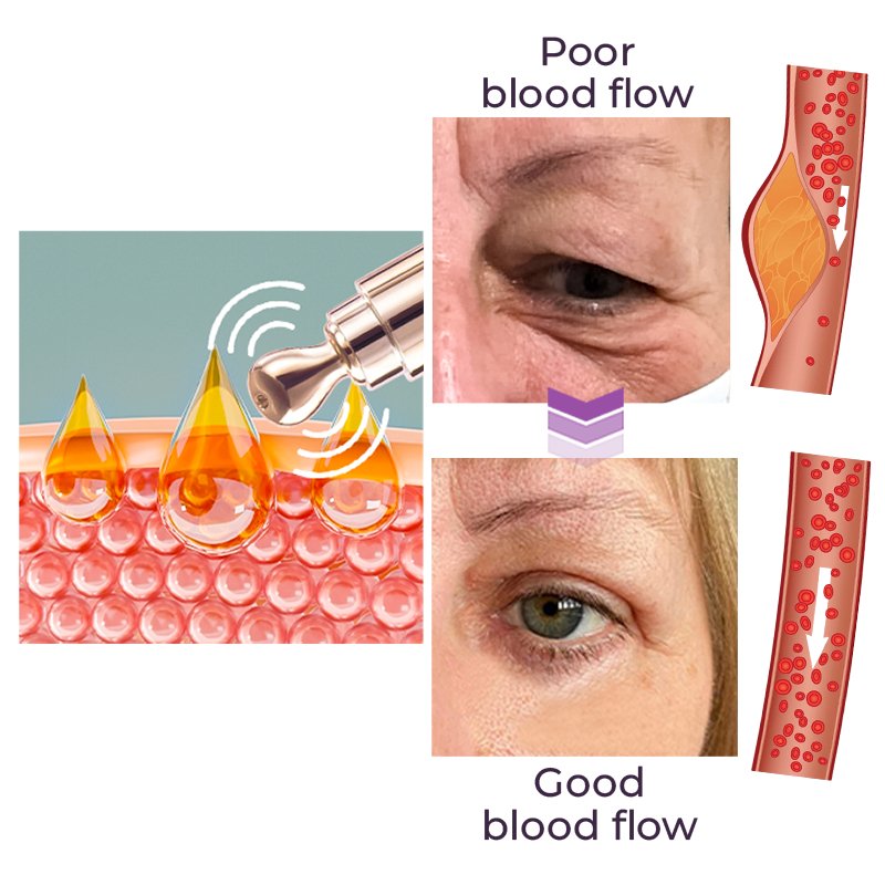 GFOUK™️ Milk Spots Therapy Electric Serum Pen - Givemethisnow