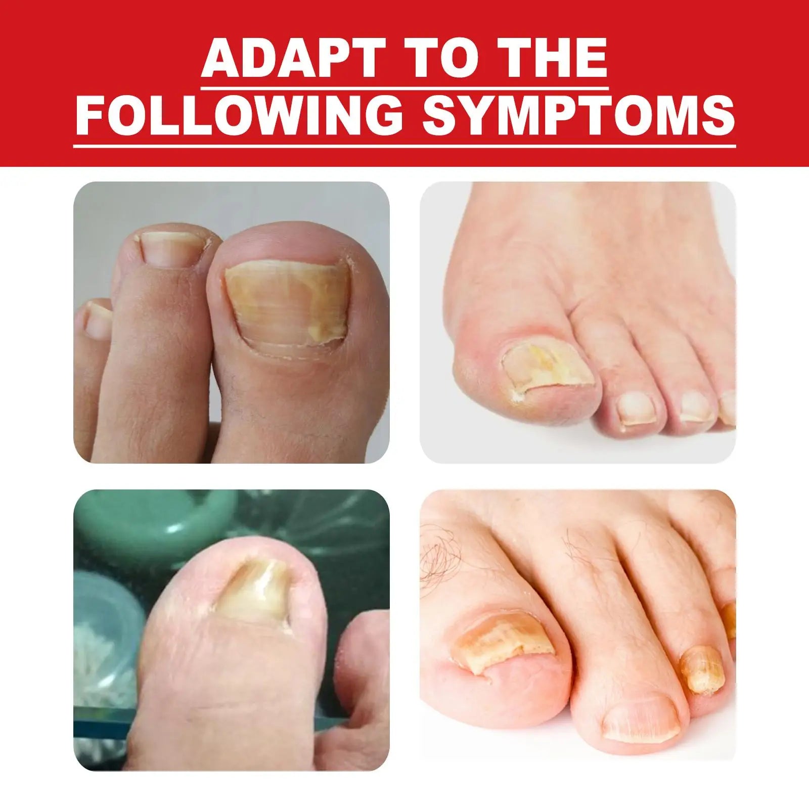 Ingrown Toenail Drops - Givemethisnow