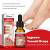 Ingrown Toenail Drops - Givemethisnow