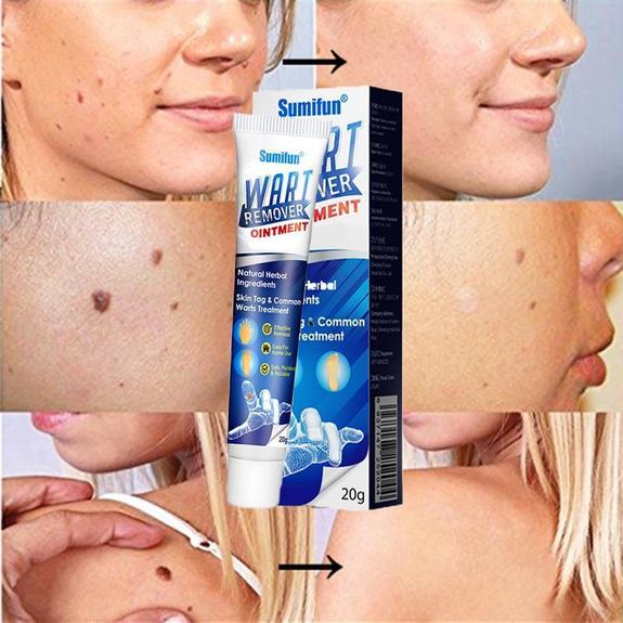 Instant Blemish Removal Gel - Givemethisnow