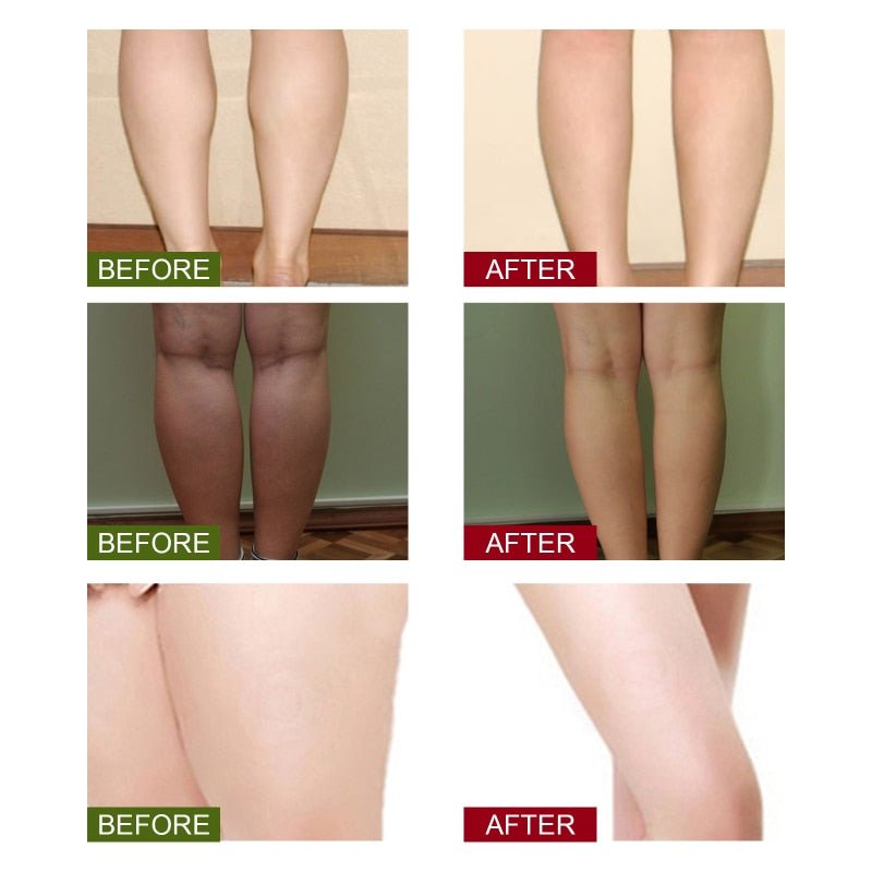 Lympatic Drainage Ginger Foot Soak - Givemethisnow