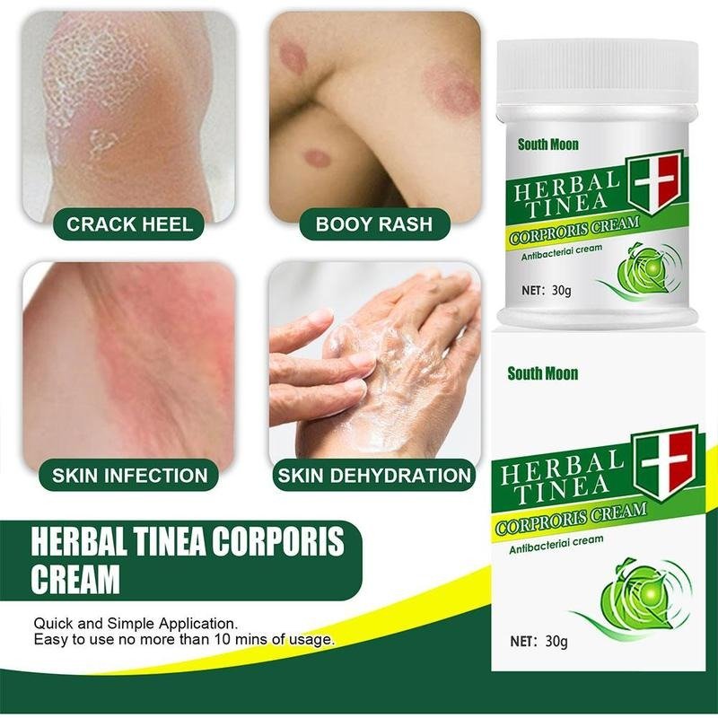Organic Herbal Tinea Corporis Cream - Givemethisnow