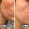 PanOxyl Acne Foaming Wash - Givemethisnow
