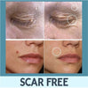 Skin Tag Remover Patches - Givemethisnow