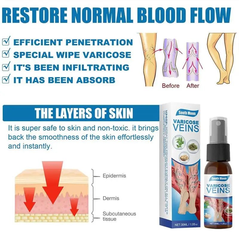 South Moon Varicose Vein Spray - Givemethisnow