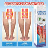 South Moon Varicose Vein Spray - Givemethisnow