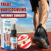 South Moon Varicose Vein Spray - Givemethisnow